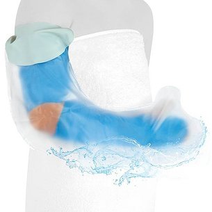 Órteses pediátricas e capas de gesso para o braço